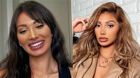 Francesca Farago Plastic Surgery Photos: Before, After